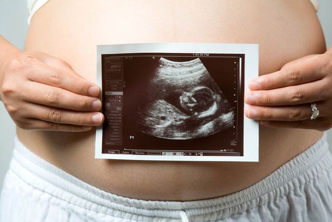 Obstetricia